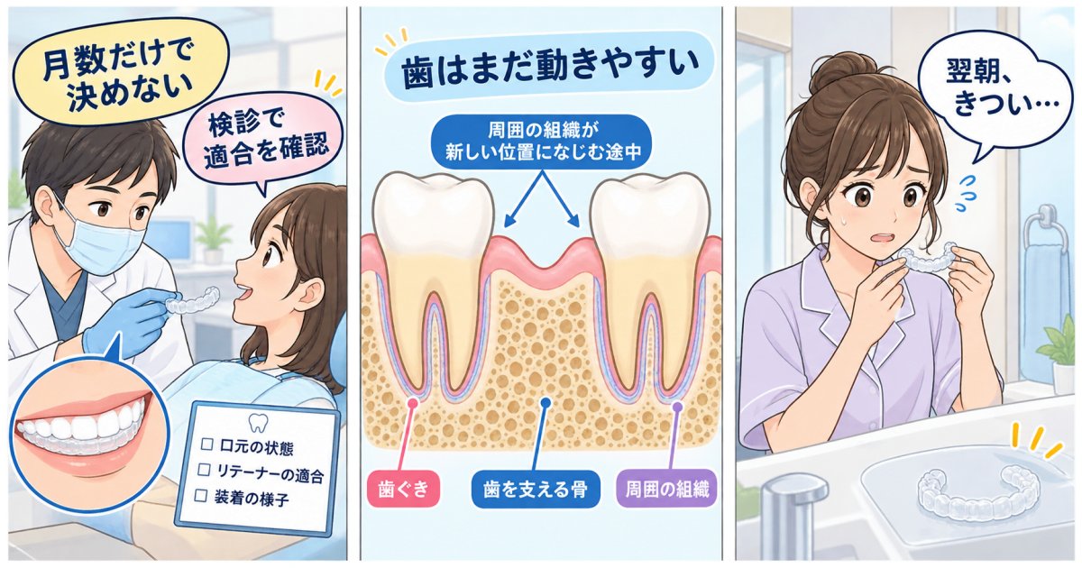 矯正後の後戻りを防ぐリテーナーの期間はいつまで？夜間のみに移行する基準