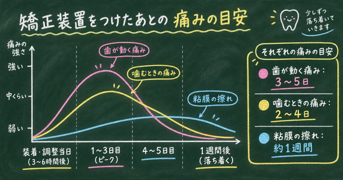 装着・調整後の痛みのピークと落ち着くまでの期間、個人差の目安